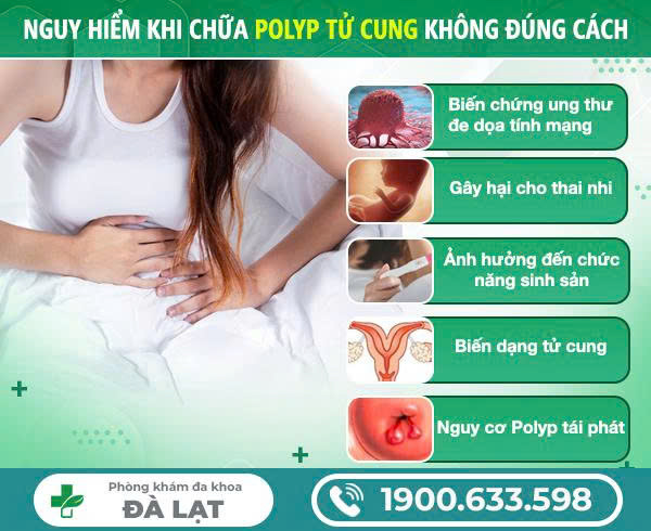 Hình ảnh minh họa